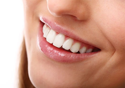 Discoloured Tooth Solution chentelham