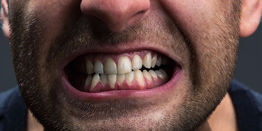 Treat Your Jaw Pain blurb cheltenham