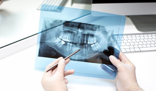 Preparation for Dental X-rays cheltenham