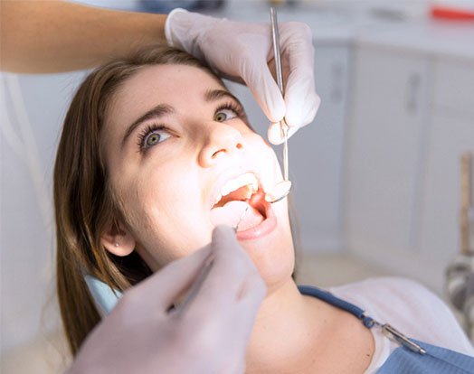 tooth filling procedure cheltenham