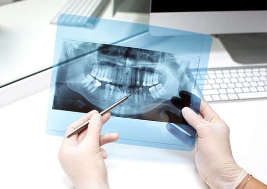 preparation for dental x-rays cheltenham