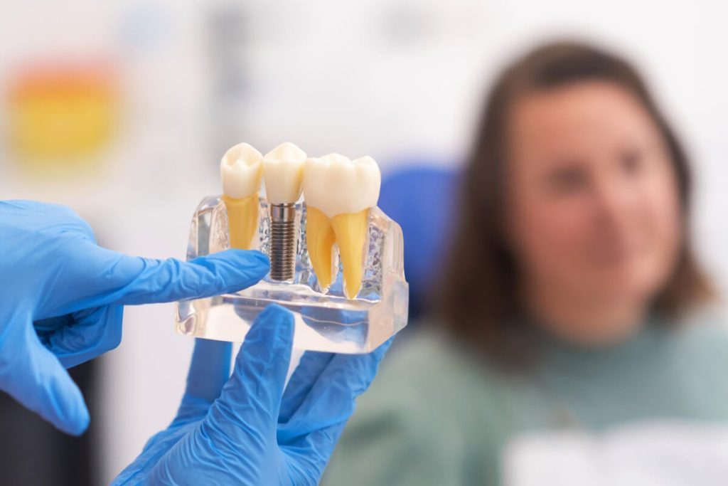 are dental implants the long-term solutions for lost teeth