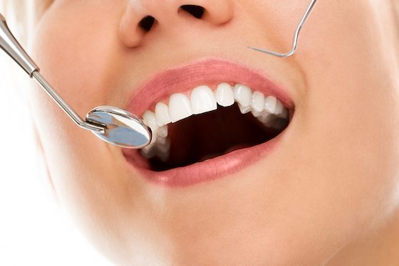 treatment for gum disease cheltenham