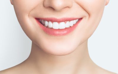 Why Teeth Whitening Should be Done by Dentists and Not Other Clinicians